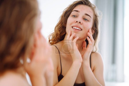 Jeune femme avec des boutons sur le visage. La vie avec l'acné. Problème de peau sujette aux éruptions cutanées et à l'acné, cicatrices. Dermatologie et concept de cosmétologie. Concept d'allergie. 