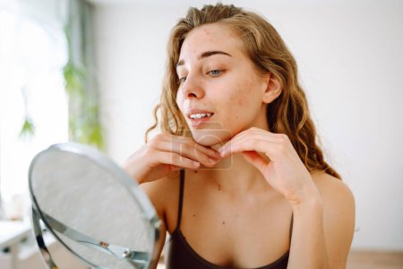 Young woman with red spot unhappy about acne and skin imperfections, looking at reflection in mirror in bathroom. Facial skin care. Acne problem.