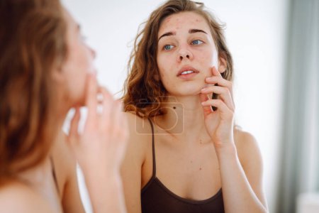 Beautiful young woman with problematic skin.  Acne problem concept
