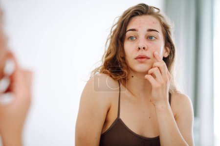 Beautiful young woman with problematic skin.  Acne problem concept