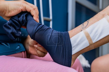 Enfermera doméstica poniendo medias de compresión en mujer con pie roto debido a fractura de peroné. Pie tatuado. Caminando con muletas. Concepto de salud y atención.