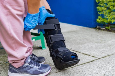 Hausangestellte in blauen Handschuhen schienen eine Patientin mit gebrochenem Fuß wegen eines gebrochenen Wadenbeins auf. Gehen auf Krücken. Konzept von Gesundheit und Pflege.