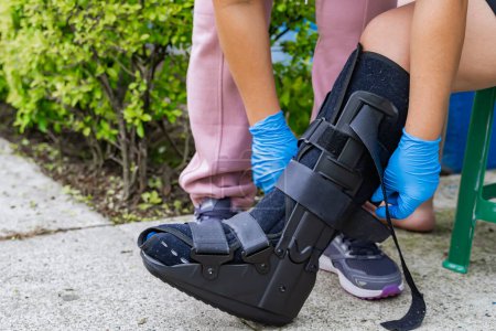 Infirmière domestique en gants bleus attelant une patiente avec un pied cassé à cause d'une fracture du péroné. Marcher sur des béquilles. Concept de santé et de soins. 