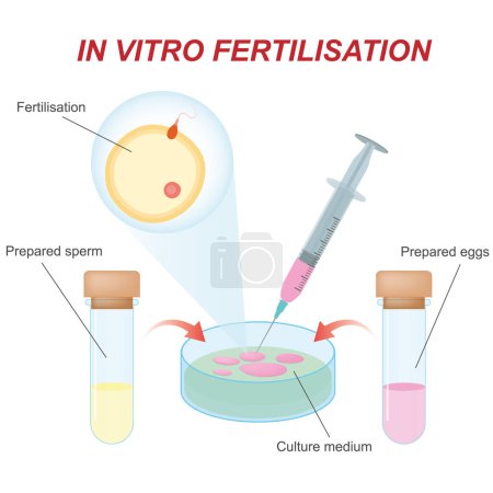 fertilizacion