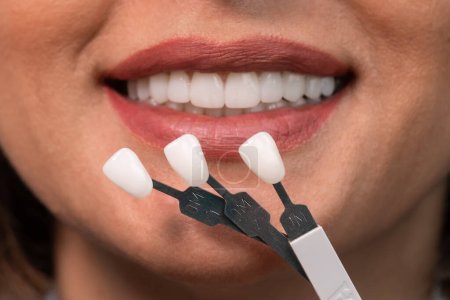 Concept de blanchiment. Soins dentaires, implants pour placages. Belle femme caucasienne avec un sourire parfait choisit le ton des dents dans la clinique dentaire. Médecine moderne.