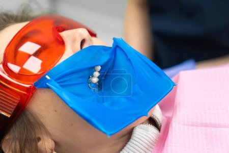 Close-up of a young female patient with a dental cofferdam installed in a dental office. Dentist uses a dental dam to isolate the tooth