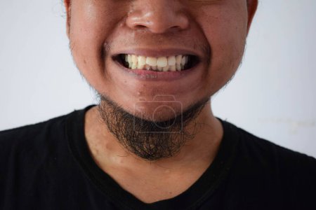 Foto de Adulto asiático hombre mostrando dientes en gris fondo. - Imagen libre de derechos