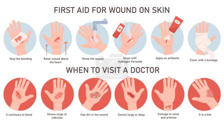 Emergency situation and first aid treatment for wound on hand skin infographic medical poster. Vector illustration rescue procedure to stop bleeding and infection spread, dangerous stage and risk case