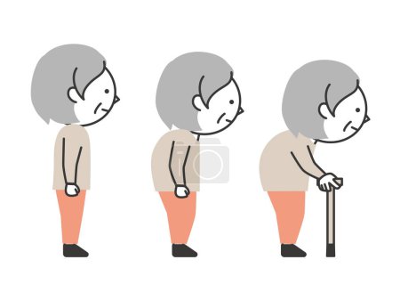 Illustration for Progress of bending of the waist in senior women. Upright posture and bent at the waist with a cane. A simple and cute cartoon-style senior illustration. - Royalty Free Image