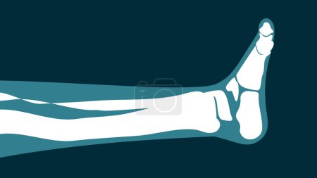 Photo for X-ray image of the leg on a black background - Royalty Free Image