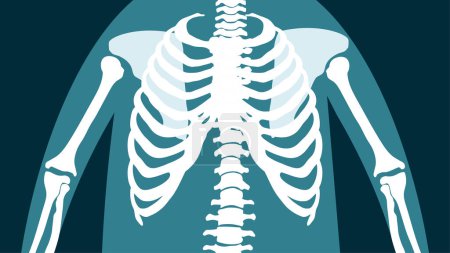 Illustration for X-ray of the human chest - Royalty Free Image