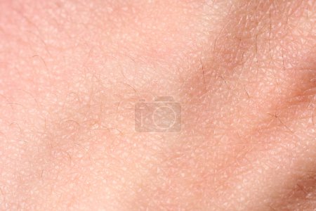 Foto de El fondo de la textura rosada de piel. Piel sana. Macro foto de células de la piel. - Imagen libre de derechos