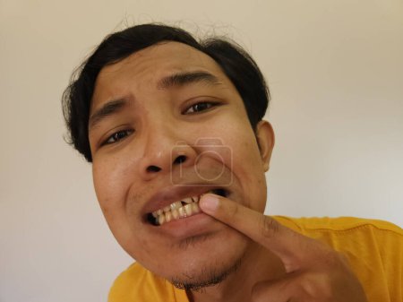 Foto de Hombre preocupado por los dientes amarillos y rotos - Imagen libre de derechos