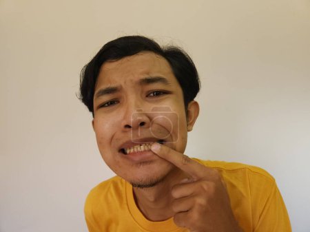 Téléchargez les photos : Homme préoccupé par les dents jaunes et cassées - en image libre de droit