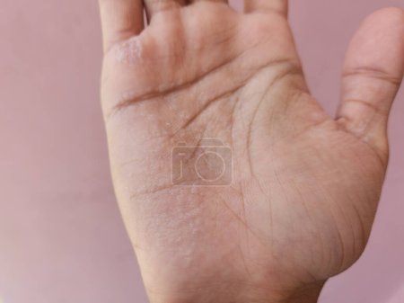 Photo for Wrinkly Hands After Swimming. Fingers get so wrinkly after bathing - Royalty Free Image