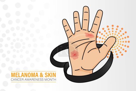 Illustration for Melanoma and Skin Cancer Awareness Month Design on May. Black Realistic awareness Ribbon - Royalty Free Image