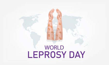 Ilustración de Vector Illustration of World Leprosy Day. Simple and Elegant Design - Imagen libre de derechos