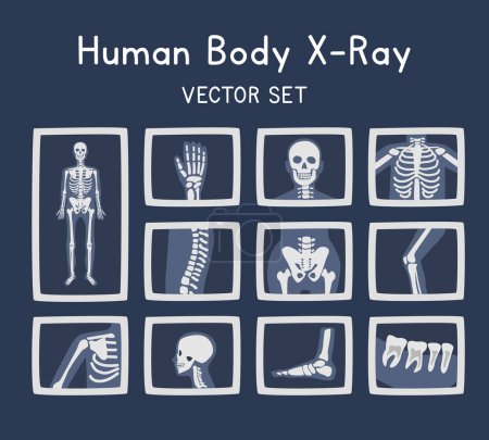 X Ray clipart estilo de dibujos animados. Huesos del cuerpo humano rayos X vector plano conjunto ilustración dibujado a mano estilo. Imagen de rayos X de diferentes partes del cuerpo. Esqueleto, mano, cráneo, columna vertebral, costilla, pelvis, pie, dientes x set de rayos