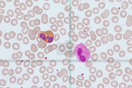 Photo for Against the background of erythrocytes there are leukocytes of various types - Royalty Free Image