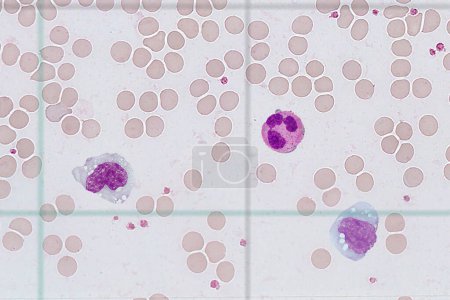 Photo for Against the background of erythrocytes there are leukocytes of various types - Royalty Free Image