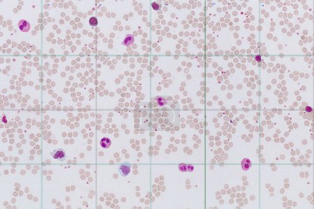 Foto de Against the background of erythrocytes there are leukocytes of various types - Imagen libre de derechos