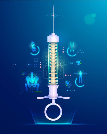 Illustration for Concept of spine implant or spine surgery, graphic of syringe with backbone inside and medical element - Royalty Free Image