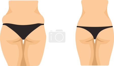 fat and slim female hips. Vector illustration