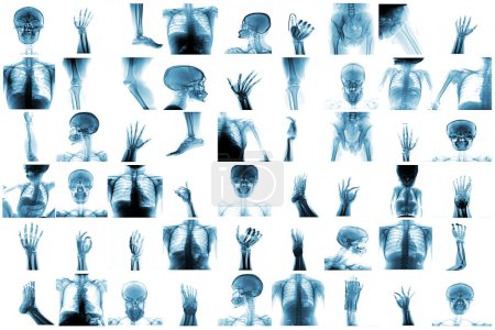 Photo for X-ray multiple part of human and many medical condition and disease - Royalty Free Image