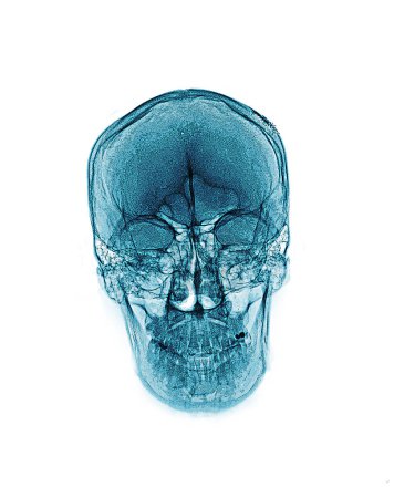 Foto de Film x-ray of normal human skull isolated. - Imagen libre de derechos