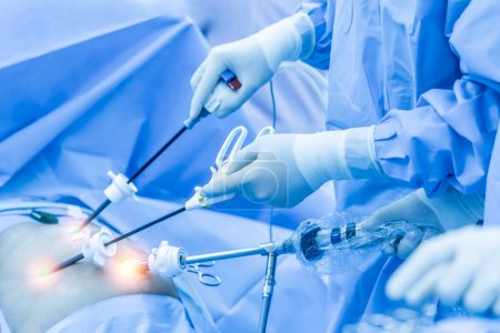 Ärzteteam führte laparoskopische Cholezystektomie im Operationssaal im Krankenhaus durch. Chirurg hält medizinisches Instrument oder chirurgisches Gerät in minimal-invasiver endoskopischer Chirurgie mit Lichteffekt.