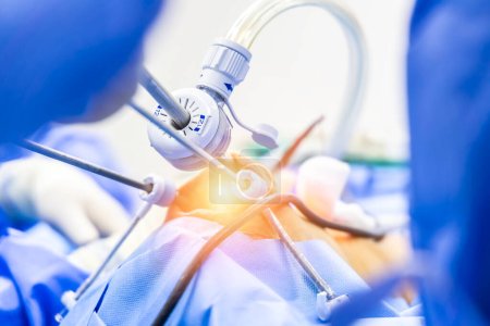 Photo for Surgeon or doctor did laparoscopy or endoscopy on minimal invasive surgery inside operating room in hospital.Surgeon in blue uniform did arthroscopic joint surgery with medical equipment or technology - Royalty Free Image