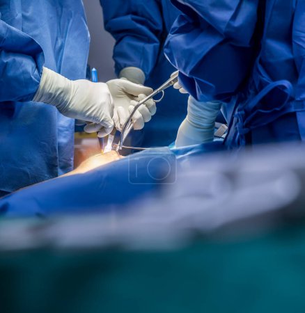 Photo for A surgeon or Doctor with nurse team in blue uniform did surgery inside operating room in hospital.Surgeon holding surgical cautery and medical equipment with light.Emergency surgery was done. - Royalty Free Image