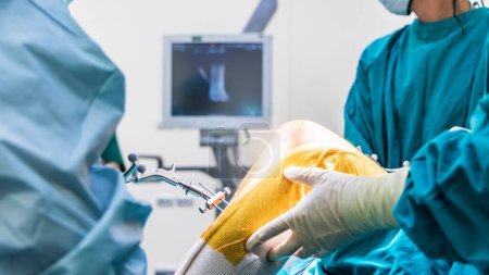 Doctor or surgeon in blue gown used robotic navigator total knee joint arthroplasty surgical instrument inside operating room.Medical technology in orthopedic surgery.Hand of people with a computer.