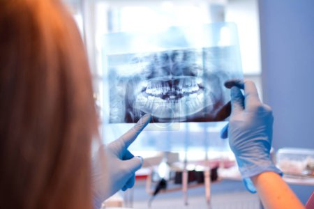 Photo for Close up female dentist pointing at patients X-ray image in dental office - Royalty Free Image