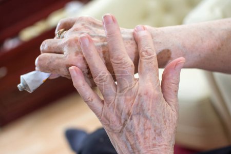 Close-up of wrinkled womans hands applying cream from tube.