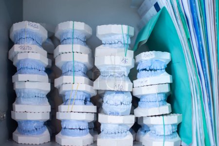 Téléchargez les photos : Modèles dentaires de gypse des mâchoires dans le bureau des dentistes - en image libre de droit