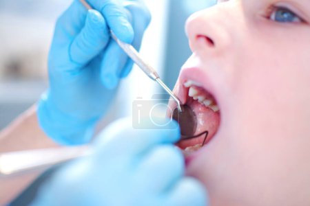 Téléchargez les photos : Gros plan de la jeune fille à bouche ouverte ayant ses dents examinées par le dentiste - en image libre de droit