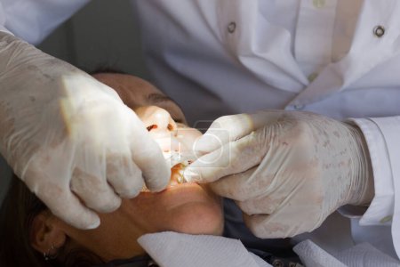 Foto de Primer plano en las manos del dentista con guantes de látex colocando protector bucal en el paciente femenino. Clínica de ortodoncia dental, concepto de higiene bucal - Imagen libre de derechos