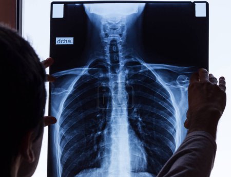 Foto de Doctor revisando la radiografía de tórax. Hombre sosteniendo la radiografía mirándolo. Examen de columna vertebral, anatomía, ciencia, profesión, trabajo, conceptos de accidente de paciente. Traducción del idioma: derecho - Imagen libre de derechos