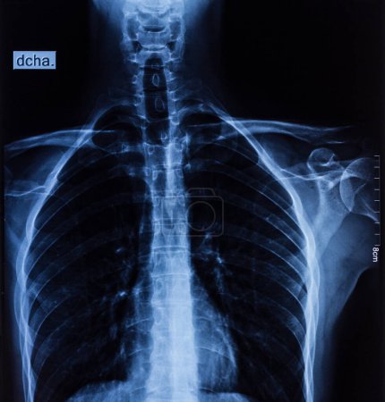 Foto de Rayos X de pulmones. Departamento de Radiografía. Examen de columna vertebral, médico, hospital, dolor, lesión, conceptos de accidente. Traducción del idioma: derecho - Imagen libre de derechos