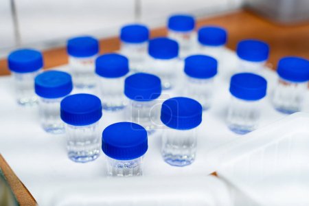 Test tubes with blue cap and transparent liquid in laboratory. Quality control process concept