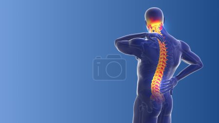 Photo for Medical concept of the neck and back pain - Royalty Free Image