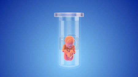 Test tube baby vitro fertilization
