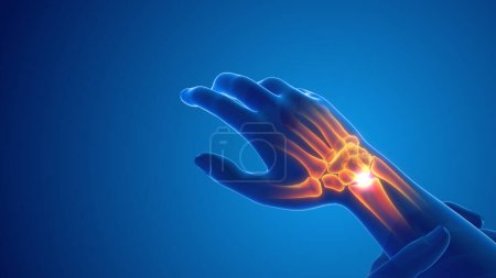 Photo for Pain in the wrist joint - Royalty Free Image