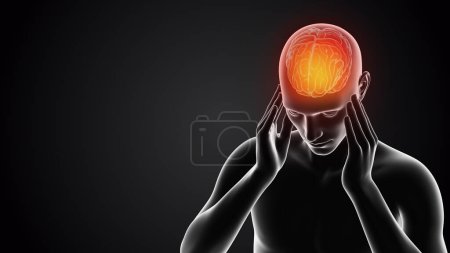 Photo for Human having pain in head - Royalty Free Image