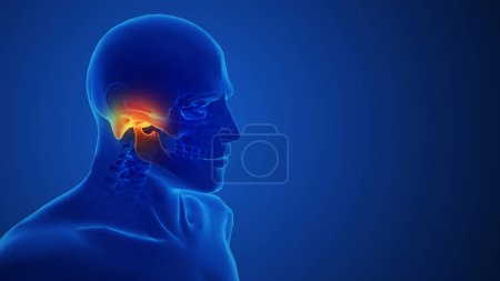 Concept d'articulation temporomandibulaire douloureuse médicale