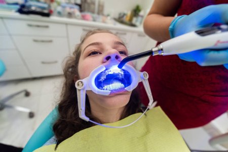 The dentist uses an ultraviolet lamp while fitting the girl with braces. 