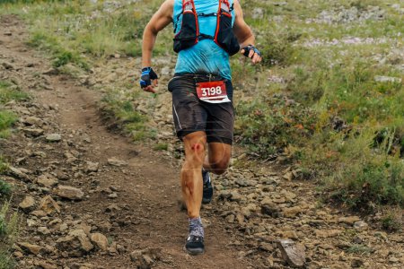 Foto de Atleta corredor corriendo montaña abajo en carrera de maratón sendero, rodilla en sangre después del otoño - Imagen libre de derechos