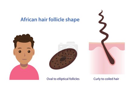 Ilustración de Infographic of African hair follicle shape vector illustration isolated on white background. Cross section of oval to elliptical follicles. Curly to coiled, frizzy, kinky hair with scalp layer. Hair anatomy concept illustration. - Imagen libre de derechos