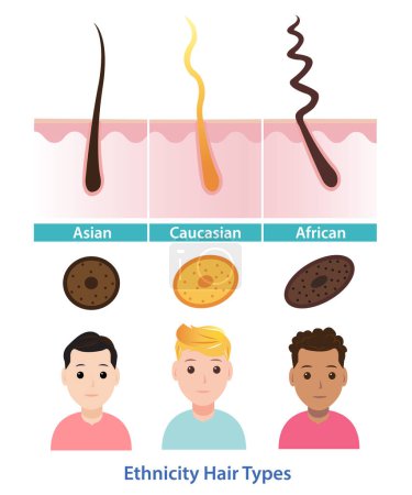 Ilustración de Diagram of ethnicity hair types vector illustration isolated on white background. The difference of hair follicle shape. Straight, wavy, curly, kinky and coiled hair with scalp layer. Hair anatomy concept illustration. - Imagen libre de derechos
